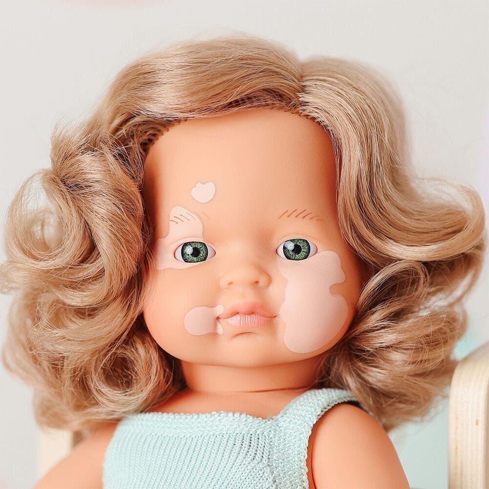 Baby Doll Caucasian Girl with Vitiligo 15in - Image 2