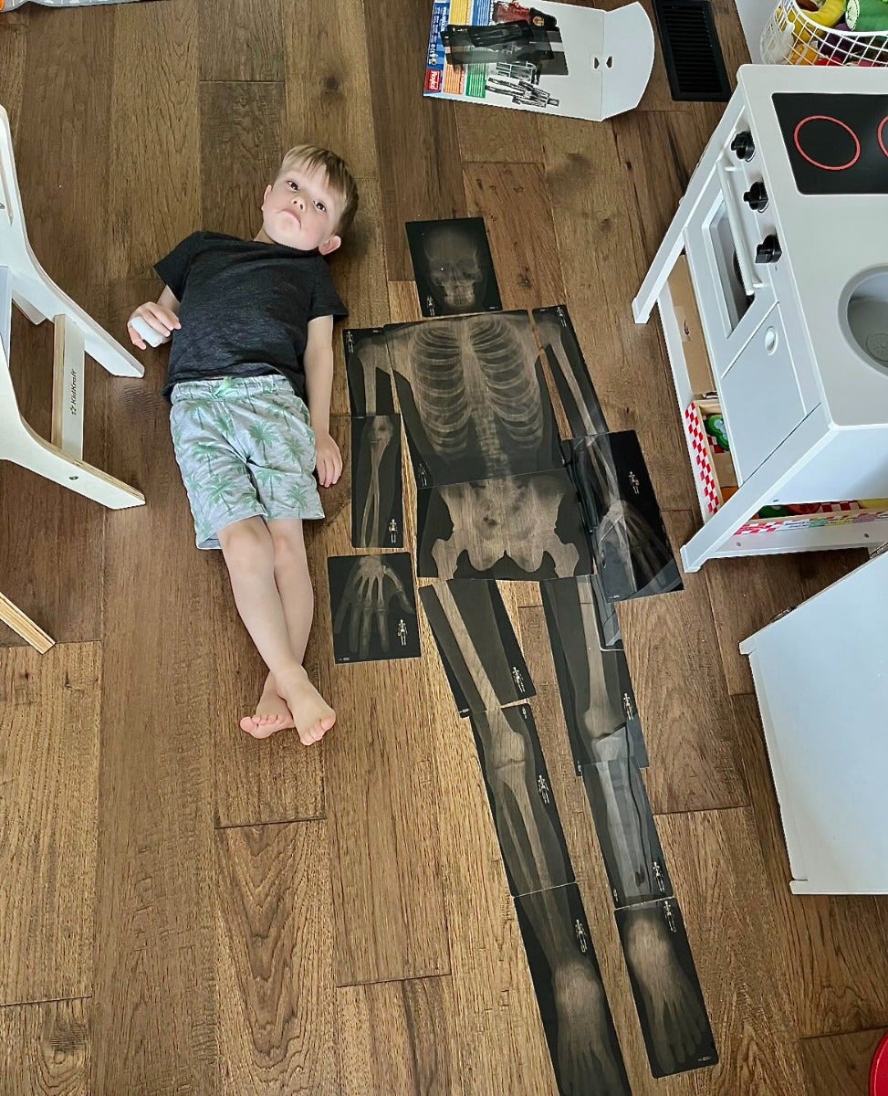 True To Life Human X-Rays - Image 2